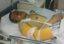 فارس بركات يرقد فى حالة سيئة بمستشفى دمنهور.jpg