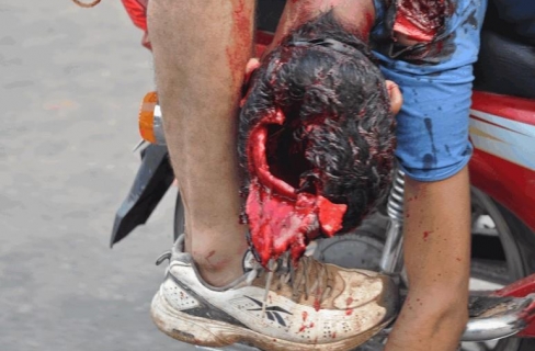 ملف:منسق مستشفى.jpg