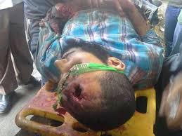 ملف:أحد شهداء مجزرة مسجد الفتح.jpg
