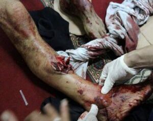 لتبرع بالدم.jpg