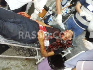 مصاب بين2.jpg