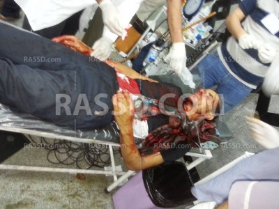 مصاب بين2.jpg