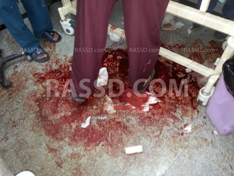 ملف:مصاب بين1.jpg